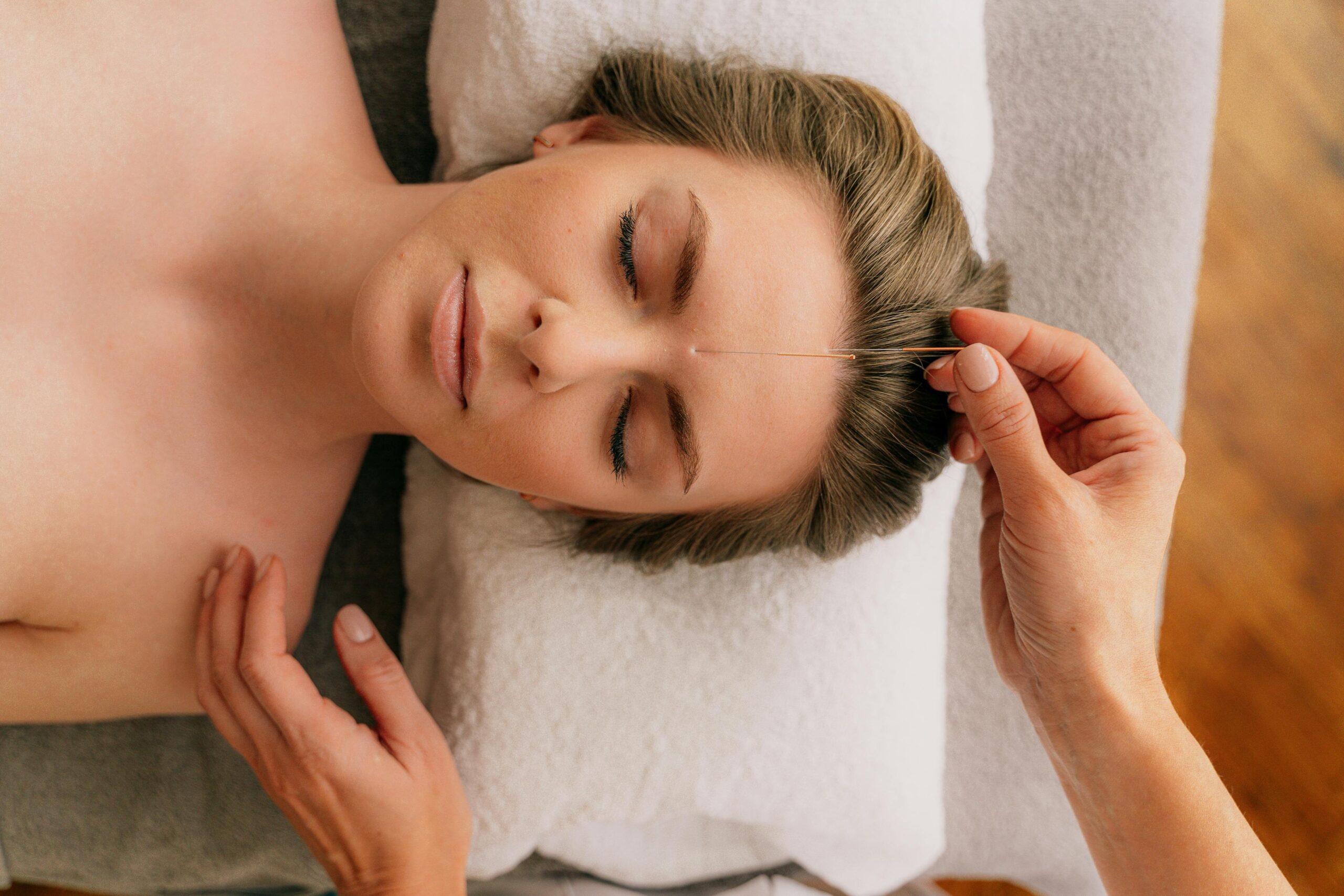 A woman meditating during an acupuncture session
