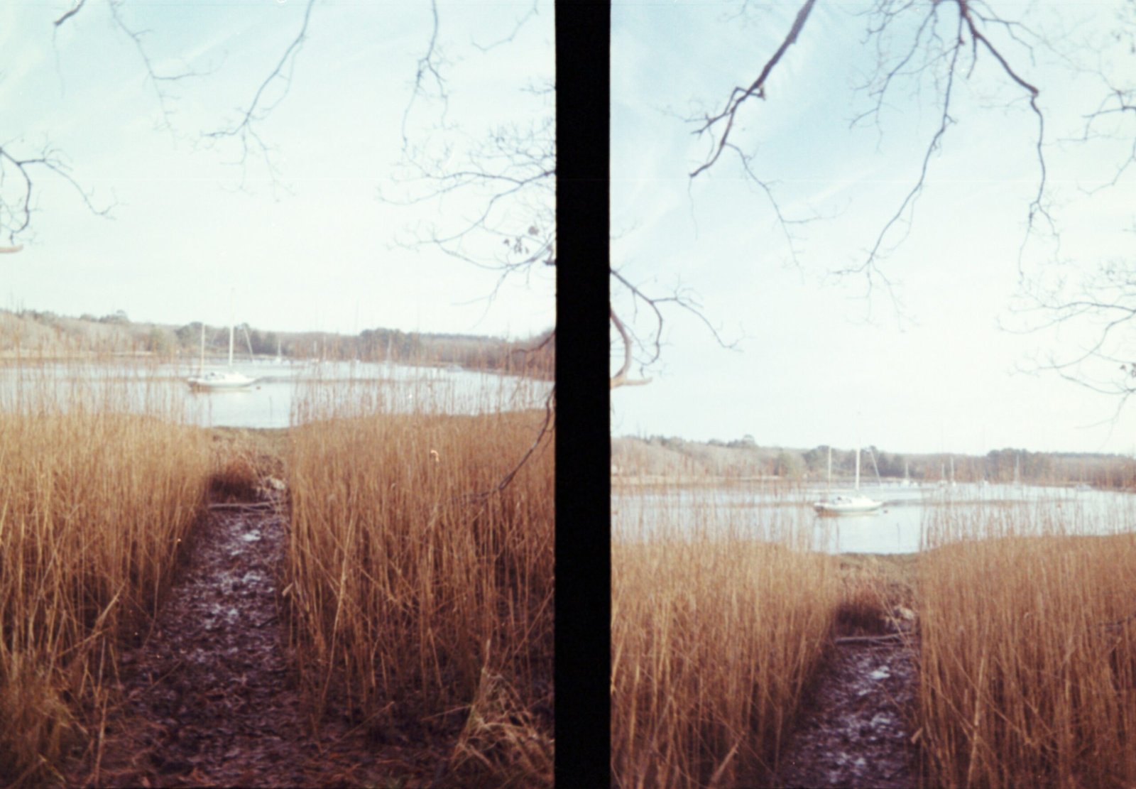 Infographic showing key acupuncture points used for weight loss.