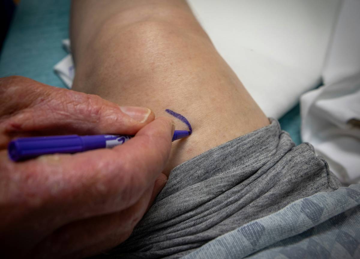 Acupuncture for Inflammation: Your Secret Weapon in Weight Loss & Health