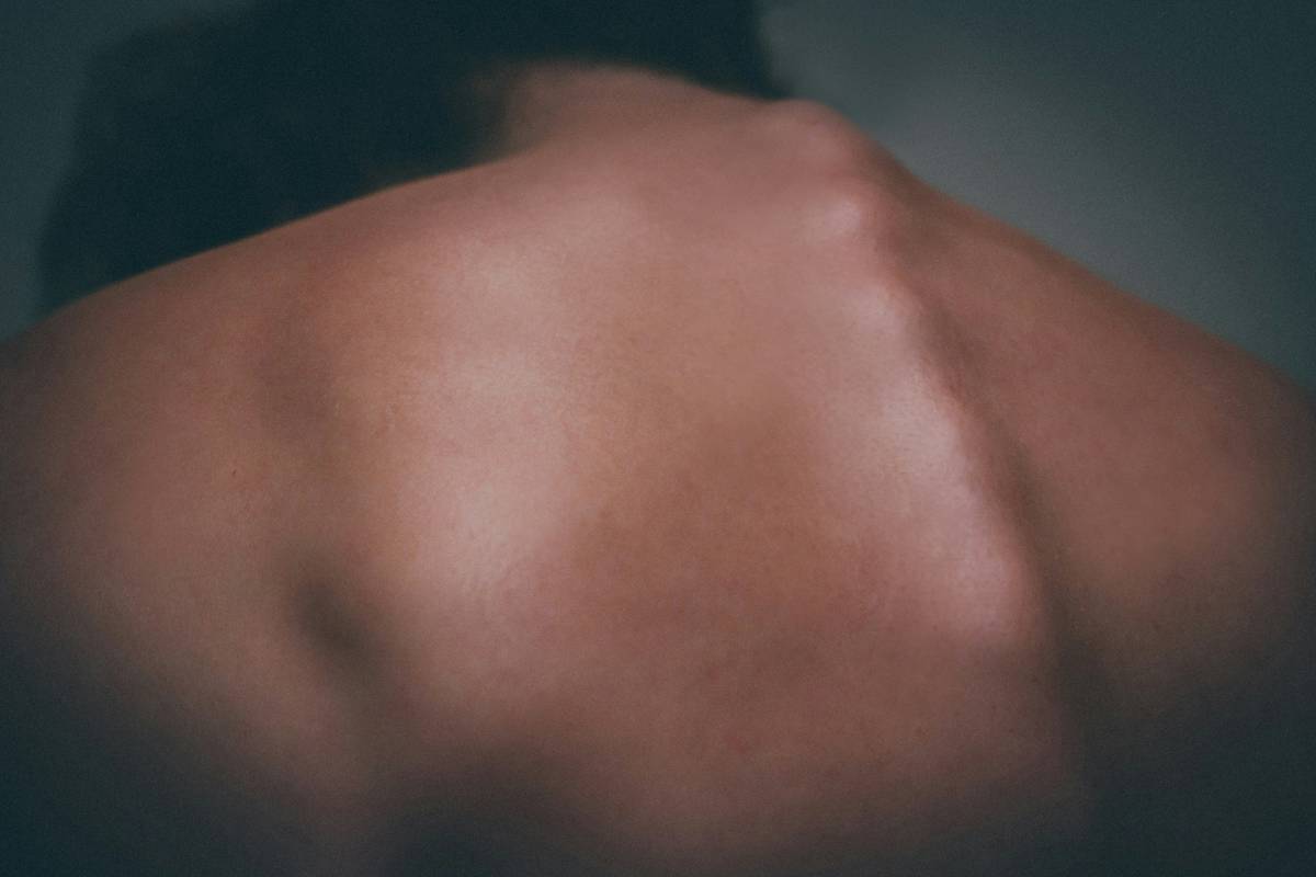 Infographic showing common causes of back fat accumulation including hormones, lifestyle, and genetics.