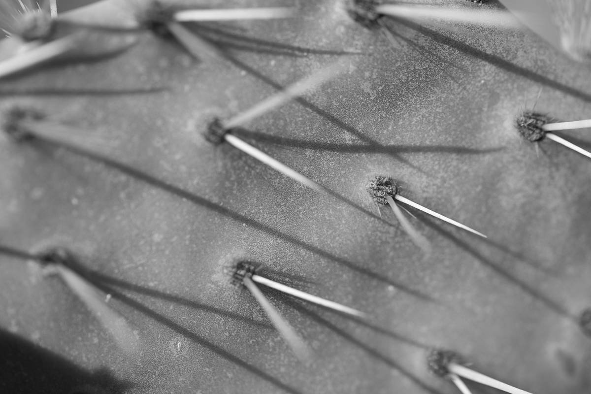 Can Acupuncture for Sugar Balance Really Help with Weight Loss? Discover the Surprising Truth