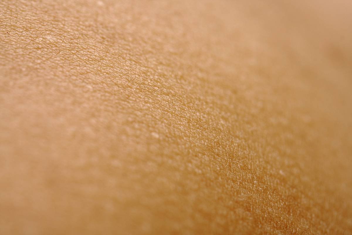A woman receiving acupuncture treatment for weight loss