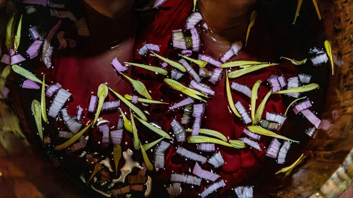 Diagram showing common acupuncture points used for weight loss.