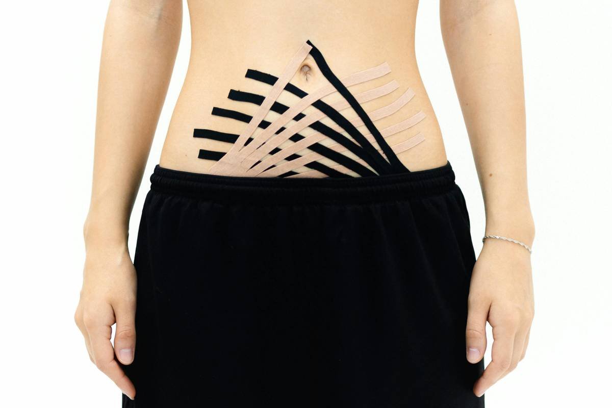 Acupuncture for Weight Loss: How Slim Needles for Thigh Fat Can Help